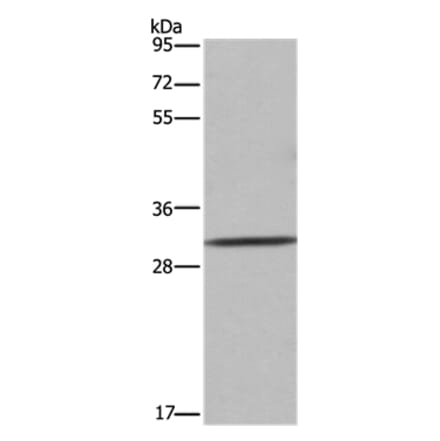 ASGR1 Antibody from Signalway Antibody (36245) - Antibodies.com