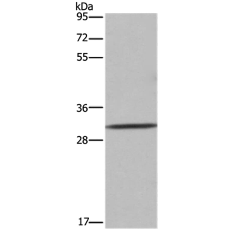 ASGR1 Antibody from Signalway Antibody (36245) - Antibodies.com
