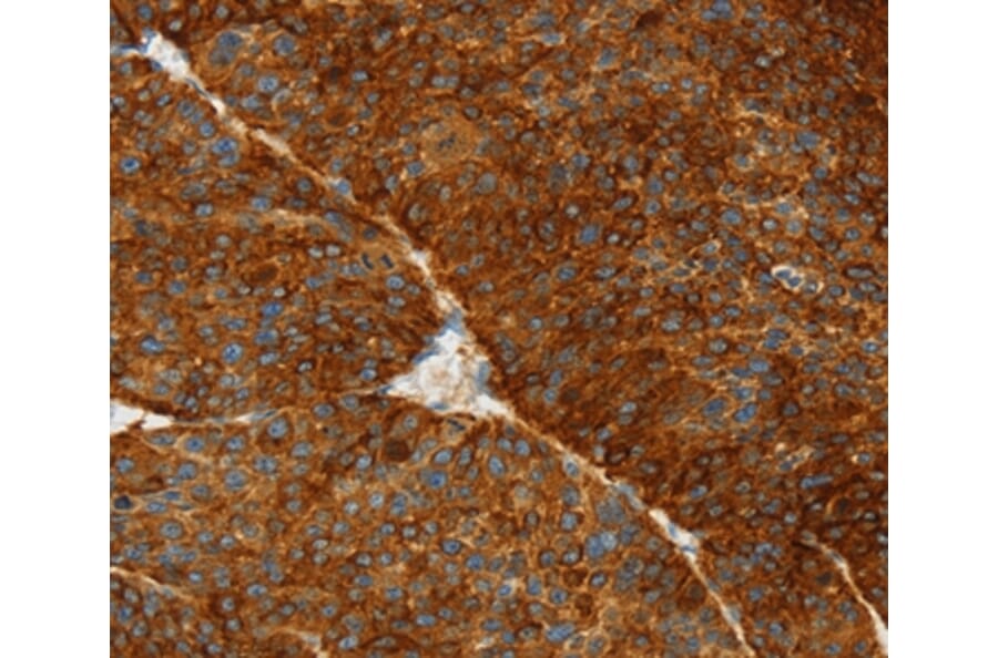 Immunohistochemistry - ASGR1 Antibody from Signalway Antibody (36245) - Antibodies.com