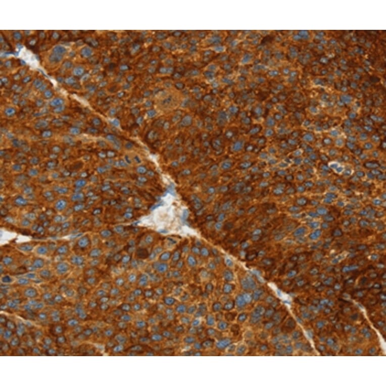 Immunohistochemistry - ASGR1 Antibody from Signalway Antibody (36245) - Antibodies.com