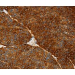 Immunohistochemistry - ASGR1 Antibody from Signalway Antibody (36245) - Antibodies.com