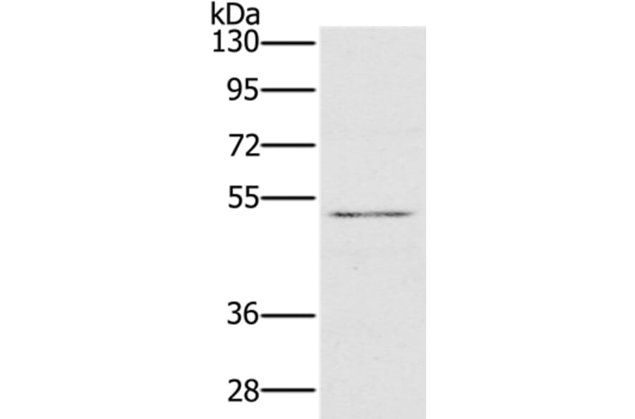 HTR3C Antibody from Signalway Antibody (36247) - Antibodies.com