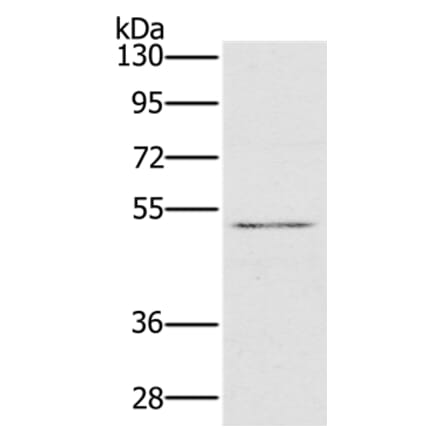 HTR3C Antibody from Signalway Antibody (36247) - Antibodies.com