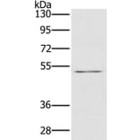 HTR3C Antibody from Signalway Antibody (36247) - Antibodies.com