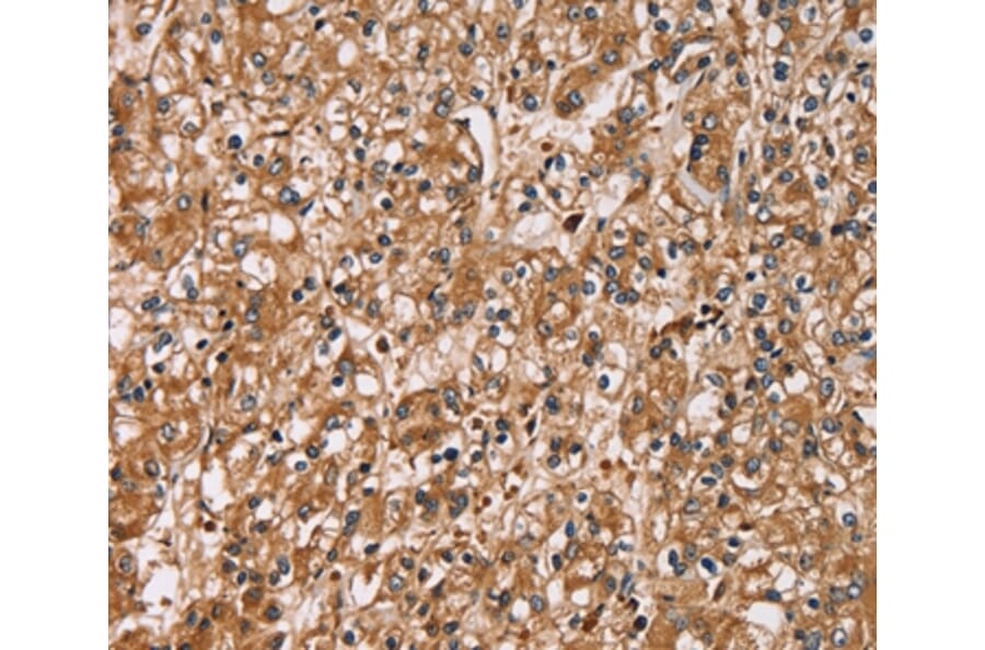 Immunohistochemistry - HTR3C Antibody from Signalway Antibody (36247) - Antibodies.com