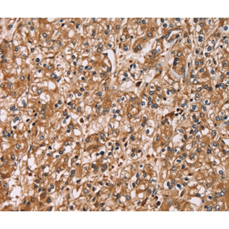 Immunohistochemistry - HTR3C Antibody from Signalway Antibody (36247) - Antibodies.com