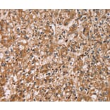 Immunohistochemistry - HTR3C Antibody from Signalway Antibody (36247) - Antibodies.com