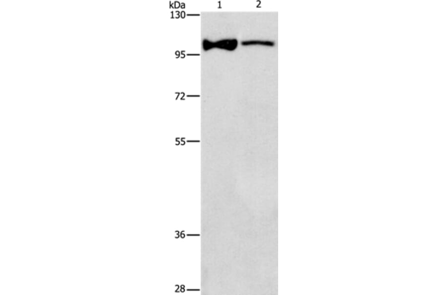 ADCY3 Antibody from Signalway Antibody (36250) - Antibodies.com