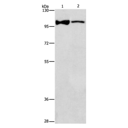 ADCY3 Antibody from Signalway Antibody (36250) - Antibodies.com