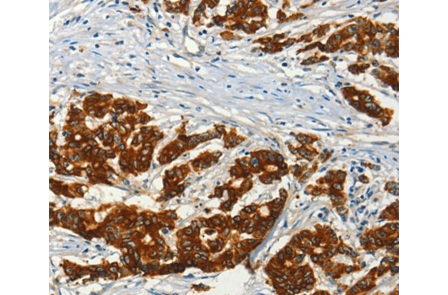Immunohistochemistry - ADCY3 Antibody from Signalway Antibody (36250) - Antibodies.com