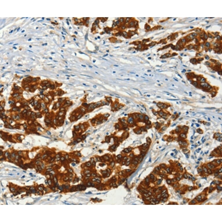 Immunohistochemistry - ADCY3 Antibody from Signalway Antibody (36250) - Antibodies.com