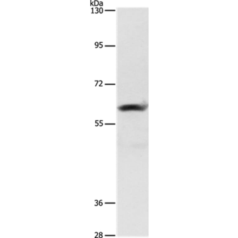 AIFM3 Antibody from Signalway Antibody (36252) - Antibodies.com