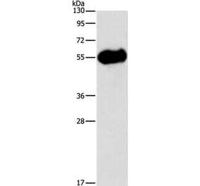 AMY2A Antibody from Signalway Antibody (36258) - Antibodies.com