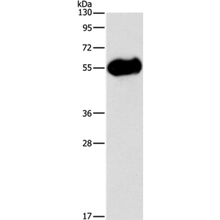 AMY2A Antibody from Signalway Antibody (36258) - Antibodies.com