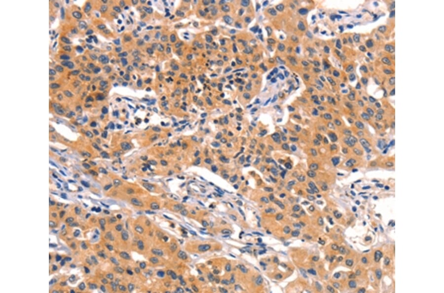 Immunohistochemistry - AMY2A Antibody from Signalway Antibody (36258) - Antibodies.com