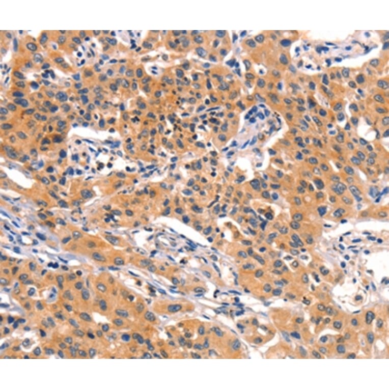 Immunohistochemistry - AMY2A Antibody from Signalway Antibody (36258) - Antibodies.com