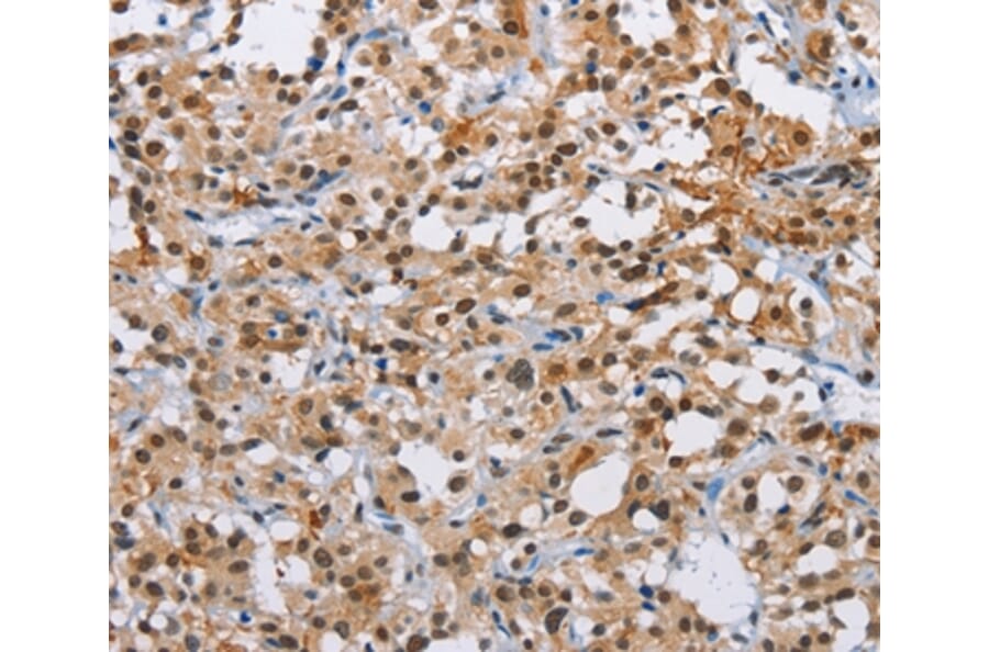 Immunohistochemistry - ATXN1 Antibody from Signalway Antibody (36271) - Antibodies.com