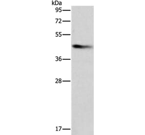 BCAT1 Antibody from Signalway Antibody (36276) - Antibodies.com