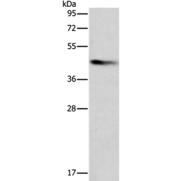 BCAT1 Antibody from Signalway Antibody (36276) - Antibodies.com