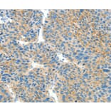 Immunohistochemistry - BCAT1 Antibody from Signalway Antibody (36276) - Antibodies.com