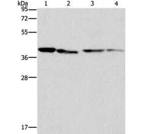 BCAT2 Antibody from Signalway Antibody (36277) - Antibodies.com