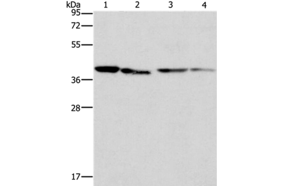 BCAT2 Antibody from Signalway Antibody (36277) - Antibodies.com