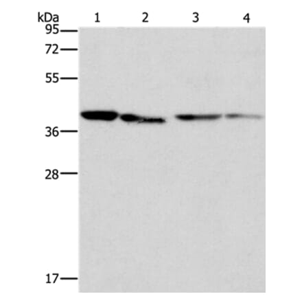 BCAT2 Antibody from Signalway Antibody (36277) - Antibodies.com