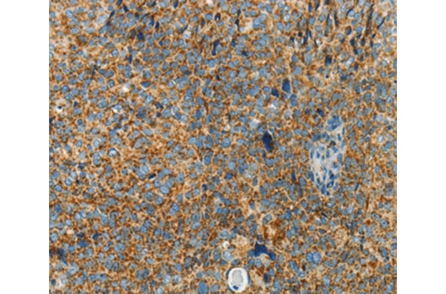 Immunohistochemistry - BCAT2 Antibody from Signalway Antibody (36277) - Antibodies.com