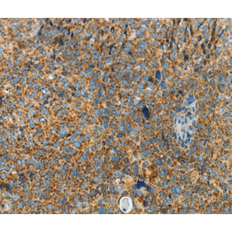 Immunohistochemistry - BCAT2 Antibody from Signalway Antibody (36277) - Antibodies.com