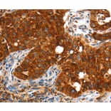 Immunohistochemistry - VWA5A Antibody from Signalway Antibody (36278) - Antibodies.com