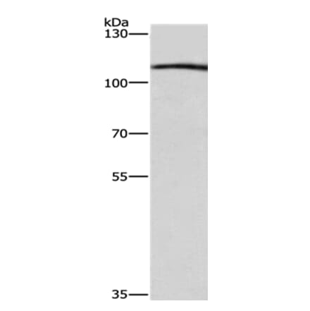 COPB1 Antibody from Signalway Antibody (36280) - Antibodies.com