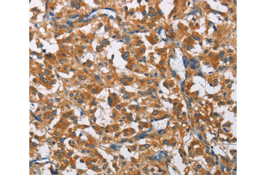 Immunohistochemistry - COPB1 Antibody from Signalway Antibody (36280) - Antibodies.com
