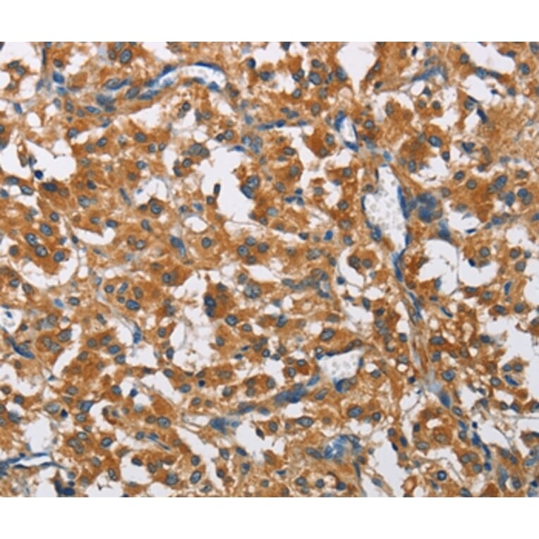 Immunohistochemistry - COPB1 Antibody from Signalway Antibody (36280) - Antibodies.com