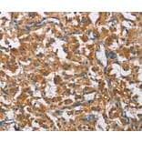 Immunohistochemistry - COPB1 Antibody from Signalway Antibody (36280) - Antibodies.com