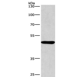 BMP15 Antibody from Signalway Antibody (36288) - Antibodies.com