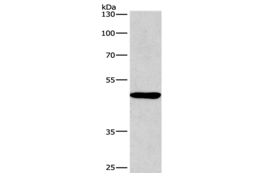 BMP15 Antibody from Signalway Antibody (36288) - Antibodies.com