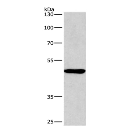BMP15 Antibody from Signalway Antibody (36288) - Antibodies.com