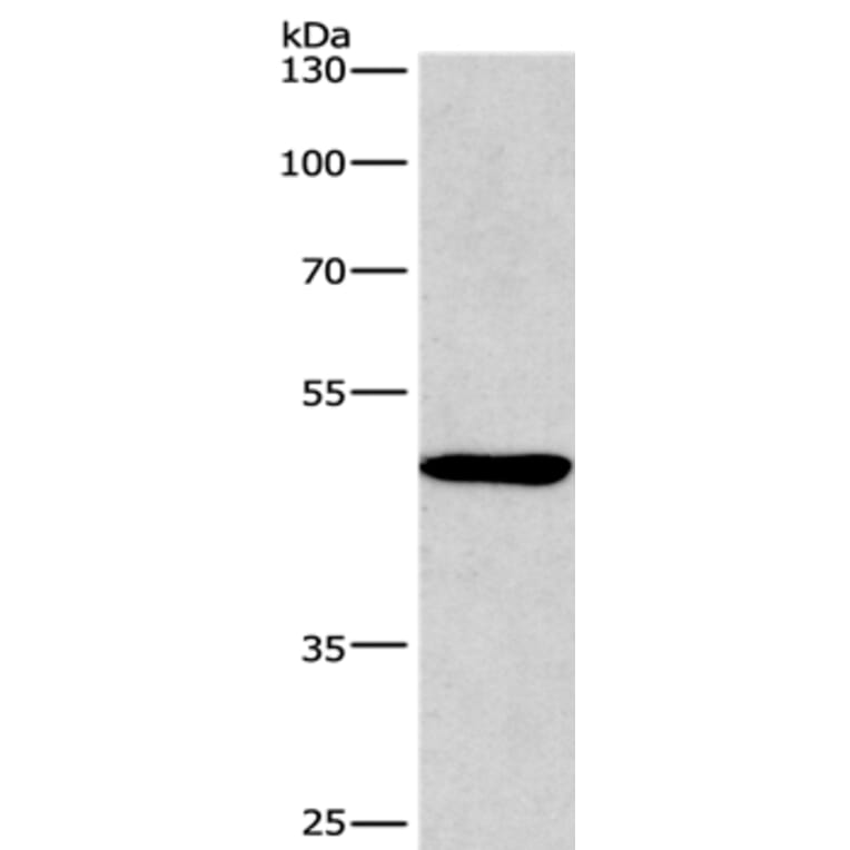 BMP15 Antibody from Signalway Antibody (36288) - Antibodies.com