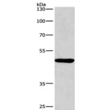 BMP15 Antibody from Signalway Antibody (36288) - Antibodies.com