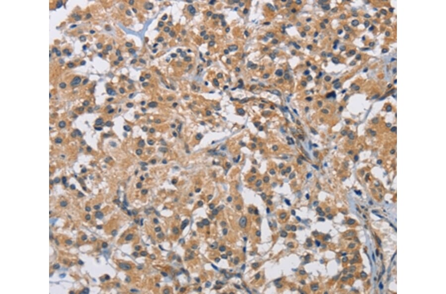 Immunohistochemistry - BMP15 Antibody from Signalway Antibody (36288) - Antibodies.com