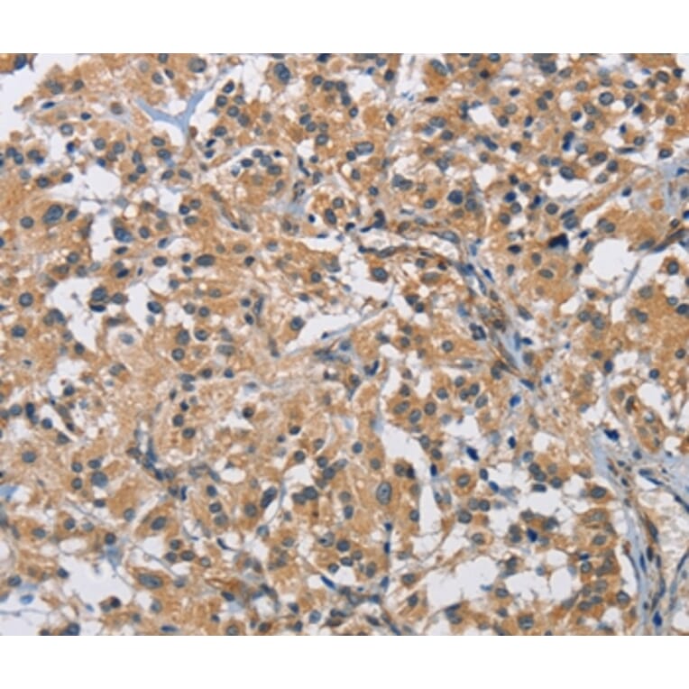 Immunohistochemistry - BMP15 Antibody from Signalway Antibody (36288) - Antibodies.com