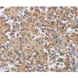 Immunohistochemistry - BMP15 Antibody from Signalway Antibody (36288) - Antibodies.com