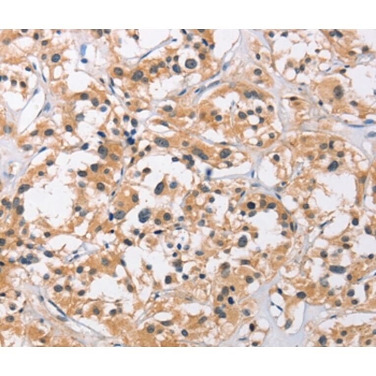 Immunohistochemistry - C3AR1 Antibody from Signalway Antibody (36294) - Antibodies.com
