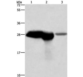 CALB1 Antibody from Signalway Antibody (36299) - Antibodies.com