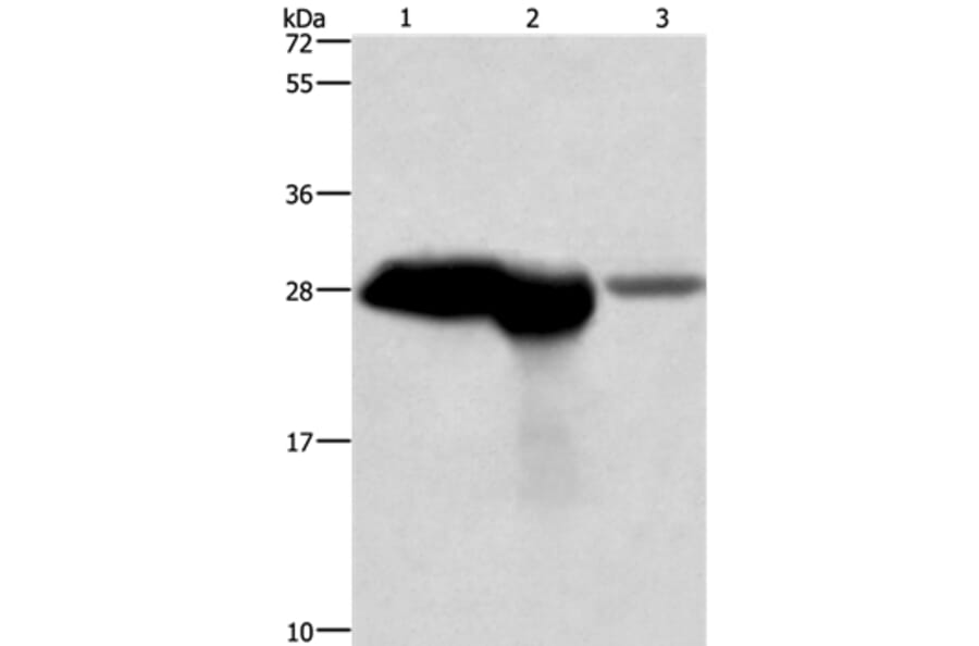 CALB1 Antibody from Signalway Antibody (36299) - Antibodies.com