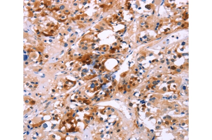 Immunohistochemistry - CALB1 Antibody from Signalway Antibody (36299) - Antibodies.com