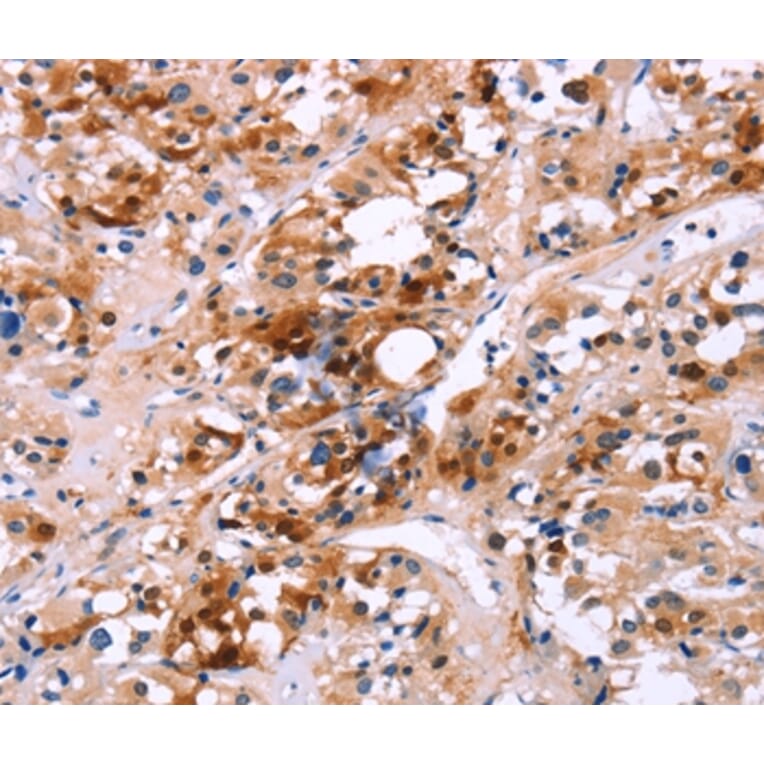 Immunohistochemistry - CALB1 Antibody from Signalway Antibody (36299) - Antibodies.com