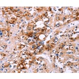 Immunohistochemistry - CALB1 Antibody from Signalway Antibody (36299) - Antibodies.com