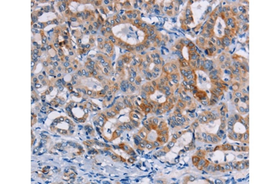 Immunohistochemistry - CASC3 Antibody from Signalway Antibody (36311) - Antibodies.com