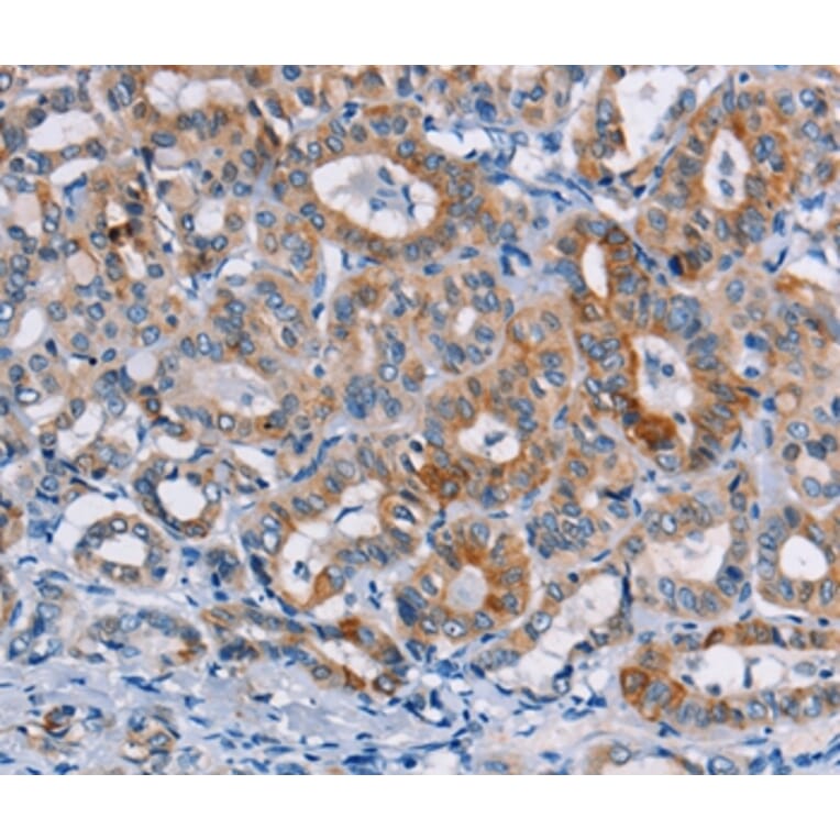 Immunohistochemistry - CASC3 Antibody from Signalway Antibody (36311) - Antibodies.com